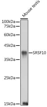 FUSIP1 Antibody