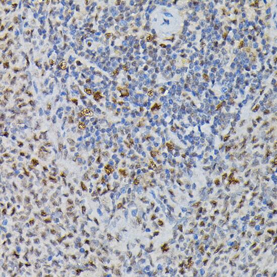 PRPF4 Antibody