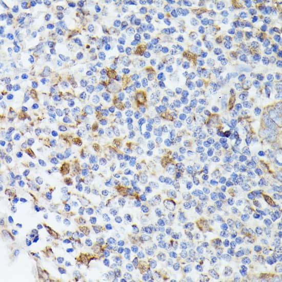 TIAL1 Antibody