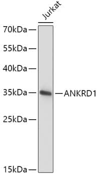 ANKRD1 Antibody