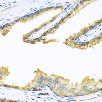 Proenkephalin Antibody