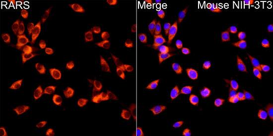 Arginyl tRNA synthetase Antibody