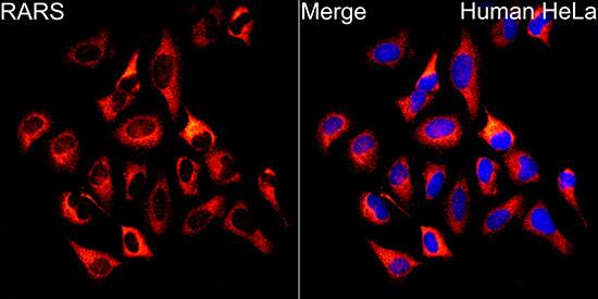 Arginyl tRNA synthetase Antibody