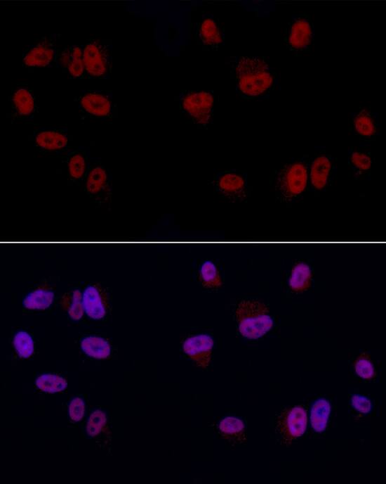 GAS41 Antibody