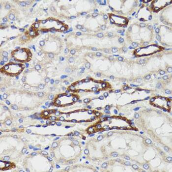 BAP29 Antibody