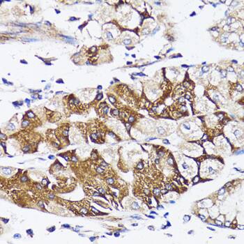 BAP29 Antibody