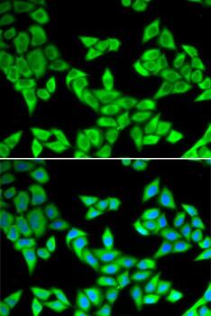 CIAPIN1 Antibody