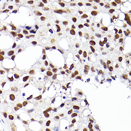 RCC1 Antibody