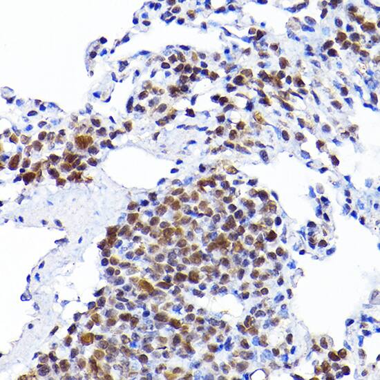 RCC1 Antibody