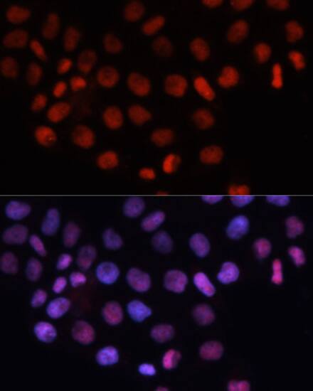 RCC1 Antibody
