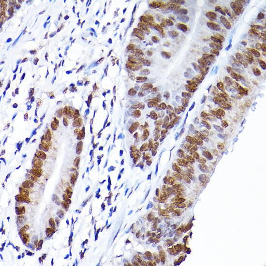 RCC1 Antibody