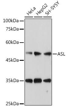 Argininosuccinate Lyase Antibody