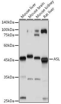 Argininosuccinate Lyase Antibody