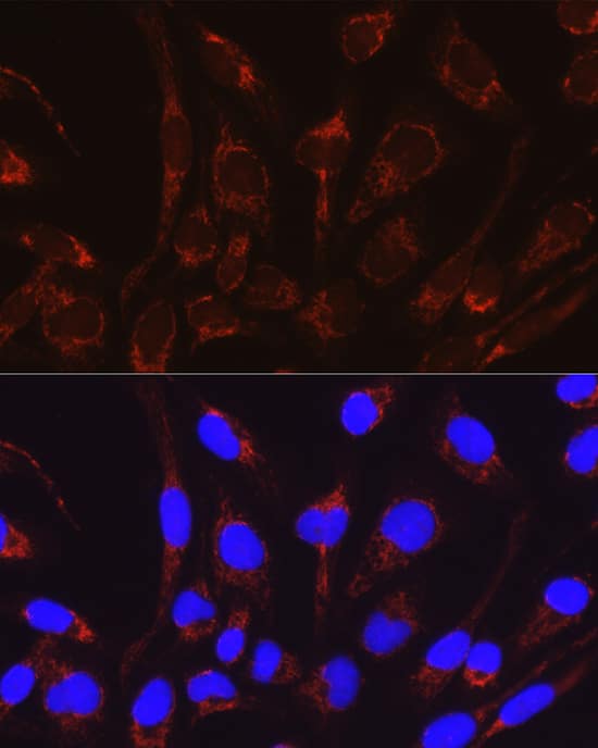 CRAT Antibody