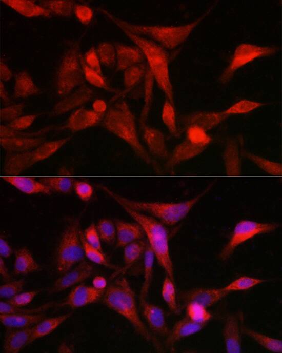 Methionine Sulfoxide Reductase A Antibody