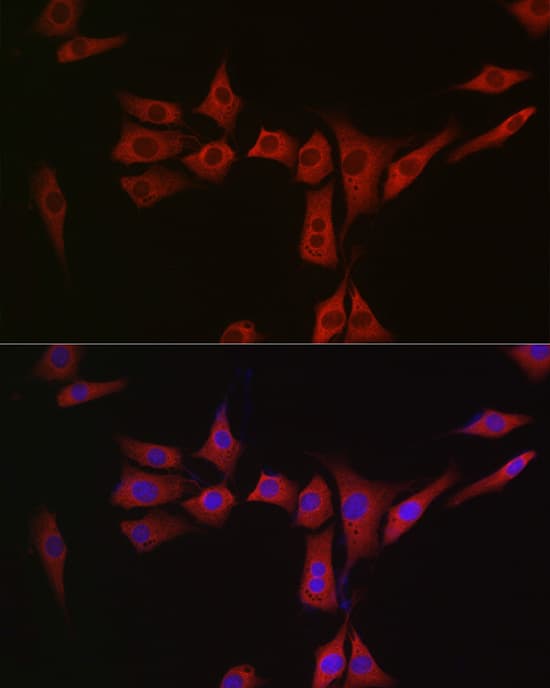 Methionine Sulfoxide Reductase A Antibody