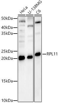 RPL11 Antibody