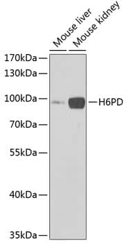 Glucose 1-dehydrogenase Antibody