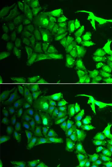 AIPL1 Antibody