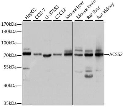 Acetyl CoA synthetase Antibody