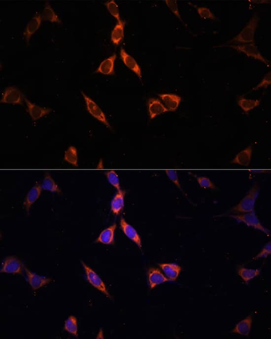 Acetyl CoA synthetase Antibody