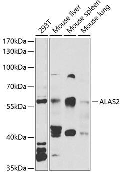 ALAS2 Antibody