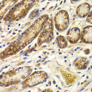 Calpain S1 Antibody