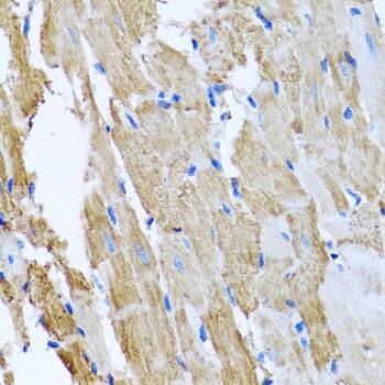 CCM2 Antibody