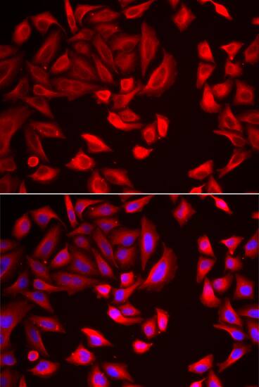 TCP1-beta Antibody