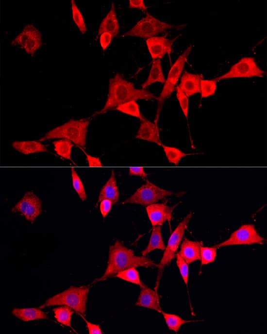 CYP4V2 Antibody