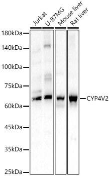 CYP4V2 Antibody