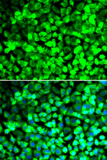 EIF5 Antibody
