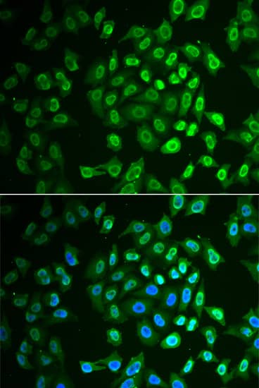 Fumarylacetoacetate hydrolase Antibody