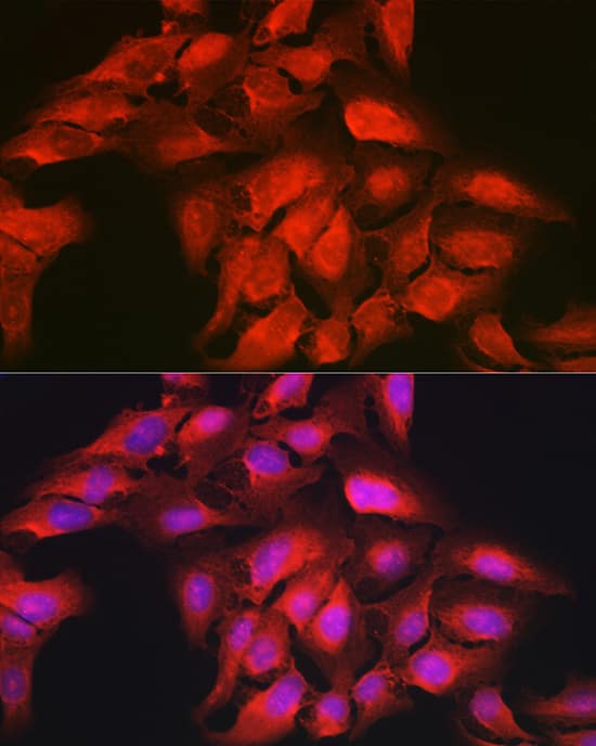 GAMT Antibody