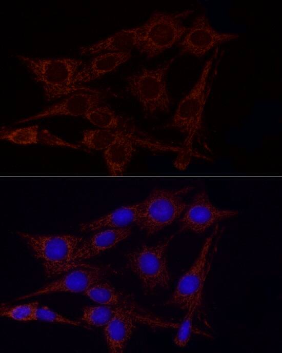 Glutamate Dehydrogenase 2/GLUD2 Antibody