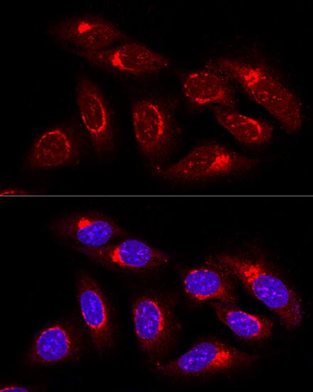 GRASP65 Antibody