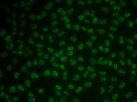 KHDRBS3 Antibody