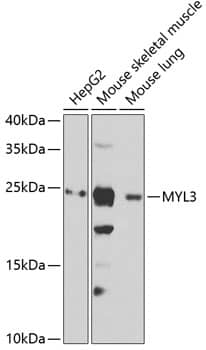 Myosin light chain 3 Antibody