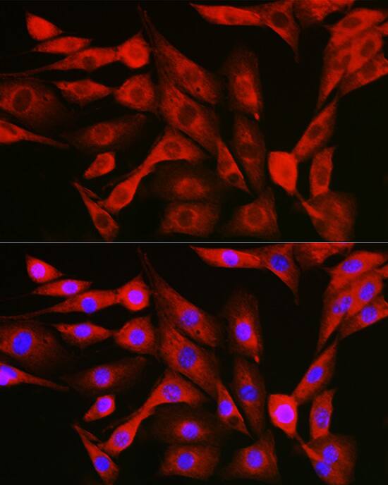 NFkB p105/p50 Antibody