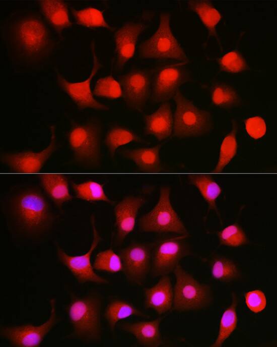 NFkB p105/p50 Antibody