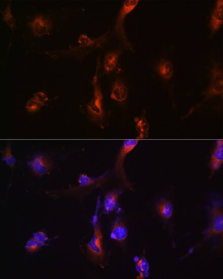 NFS1 Antibody