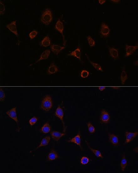 NFS1 Antibody