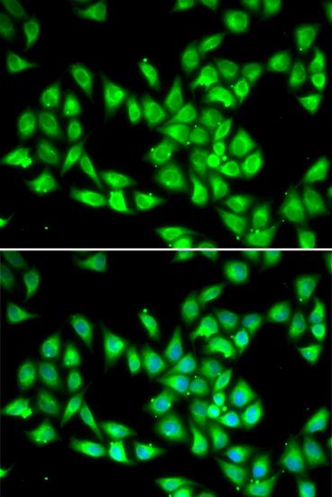 PCMT1 Antibody