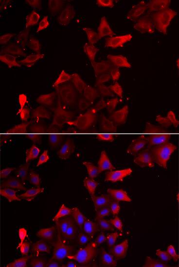 PDLIM1 Antibody