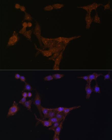 Phosphoribosyl Pyrophosphate Amidotransferase Antibody