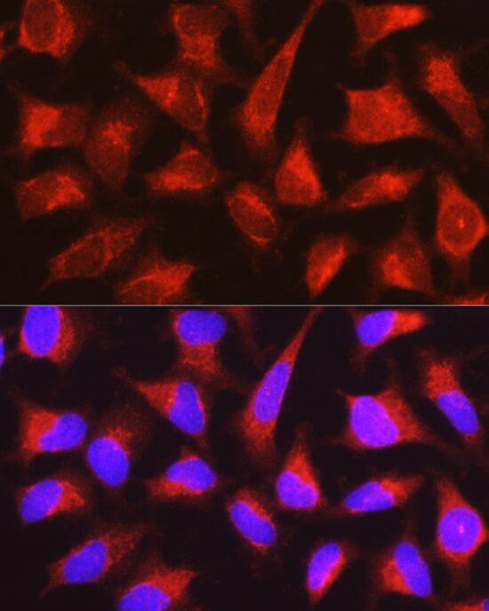 PYGL Antibody