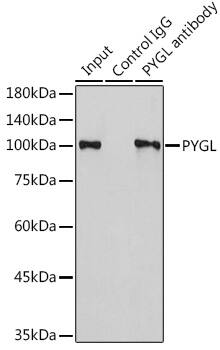 PYGL Antibody