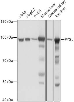 PYGL Antibody