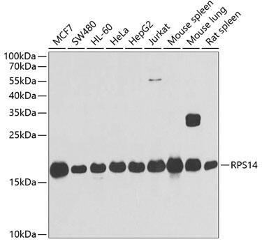 RPS14 Antibody