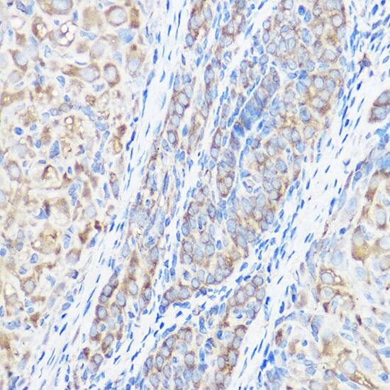 Seryl tRNA synthetase Antibody